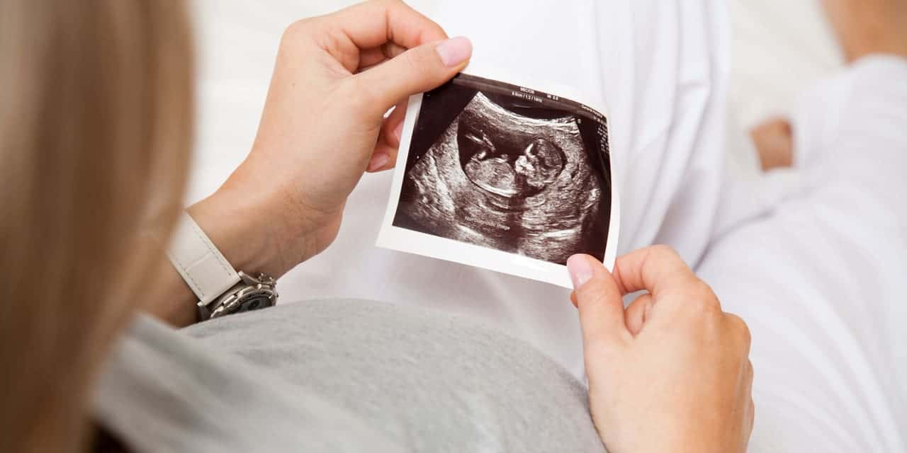Baby ultrasound