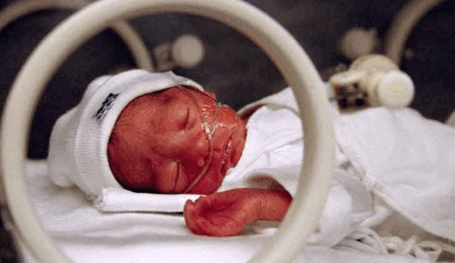 Incredible Miracle: Baby Saved From Being Abandoned in a Dumper