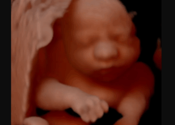 183,720 Babies Were Killed in Abortions Last Year in California