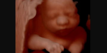 183,720 Babies Were Killed in Abortions Last Year in California