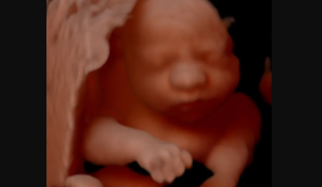183,720 Babies Were Killed in Abortions Last Year in California