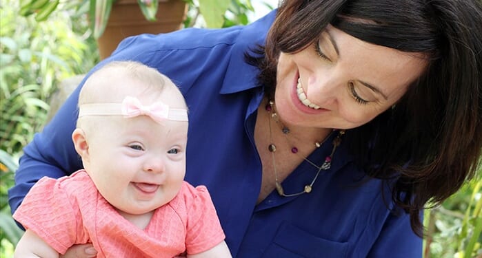 60-90% of Babies With Down Syndrome in the US are Killed in Abortions
