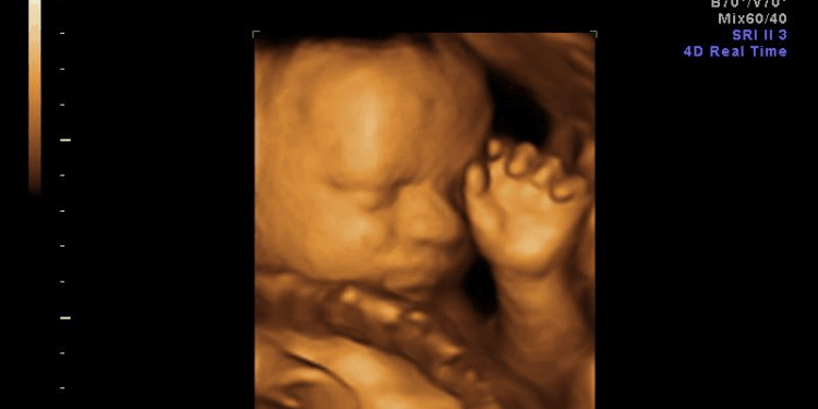 Abortion Has a Stigma Because Abortion is Killing Babies