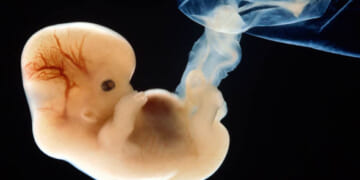 Abortion Pills Kill Babies and Hurt Women, FDA Should Take It Off the Market