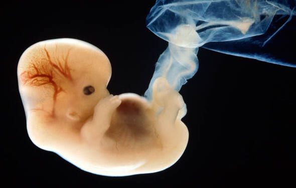 Abortion Pills Kill Babies and Hurt Women, FDA Should Take It Off the Market