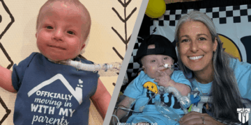 Doctors Said This Baby With Trisomy 18 Would Die in the Womb, He’s Now 15-Months Old