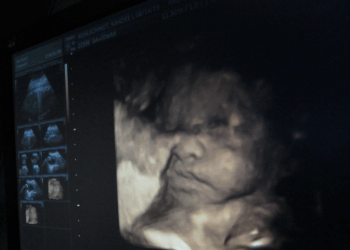 Legislators Urge Trump Admin to Take Action Against Abortion Drugs