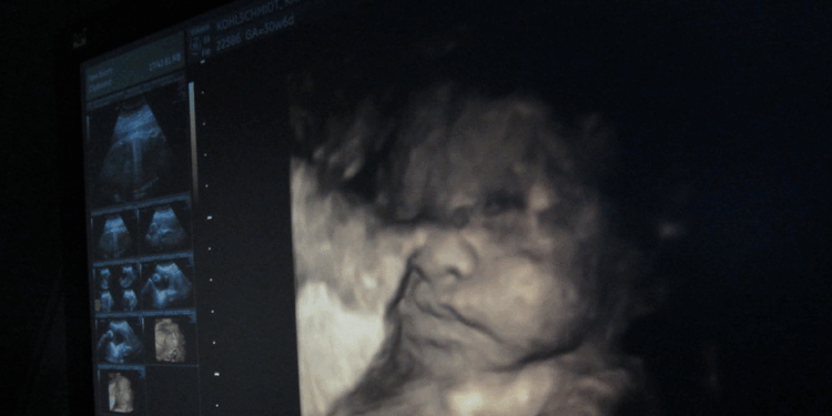 Legislators Urge Trump Admin to Take Action Against Abortion Drugs