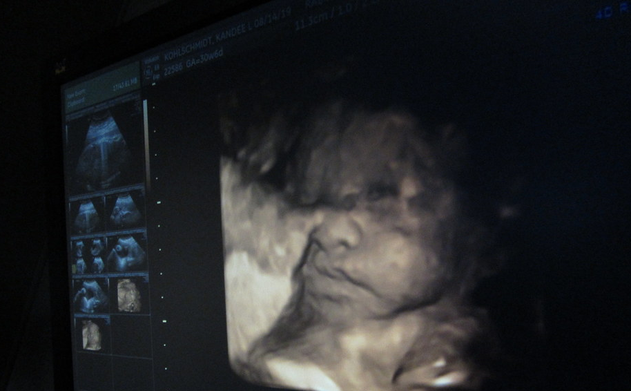 Legislators Urge Trump Admin to Take Action Against Abortion Drugs