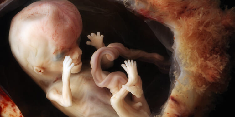 Louisiana Fights to Protect Its Pro-Life Laws Saving Babies From Abortions