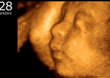 Over 100 Pro-Life Groups Tell Congress to Stop Funding Abortions in Obamacare