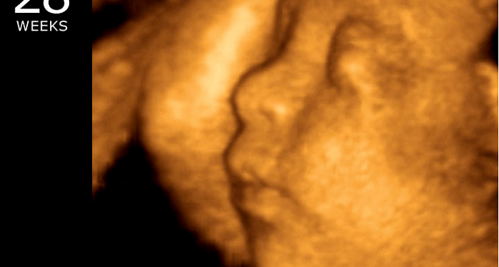 Over 100 Pro-Life Groups Tell Congress to Stop Funding Abortions in Obamacare