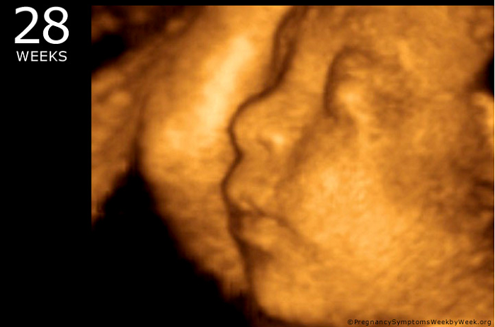 Over 100 Pro-Life Groups Tell Congress to Stop Funding Abortions in Obamacare