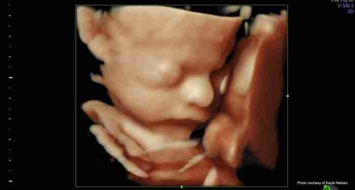 Pennsylvania Residents Urged to Oppose Radical Pro-Abortion Bills