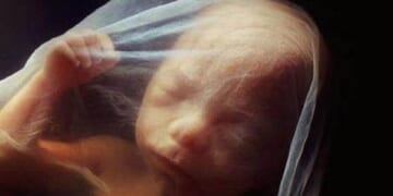 Personhood Begins at Conception, Not Sentience