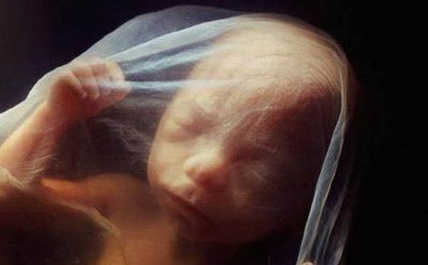 Personhood Begins at Conception, Not Sentience