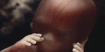 Pro-Life States Must Fight Back Against Abortion Pills