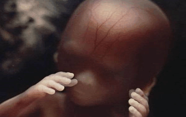 Pro-Life States Must Fight Back Against Abortion Pills