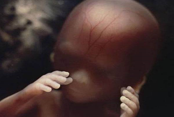 Pro-Life States Must Fight Back Against Abortion Pills