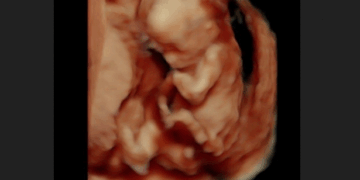 Republican States are Fighting Back Against Illegal Abortion Pills