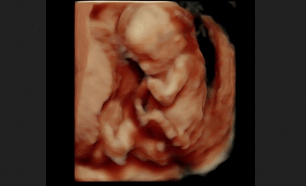 Republican States are Fighting Back Against Illegal Abortion Pills