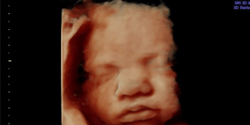 Republicans Demand Answers From FDA on Approval of Generic Abortion Pill