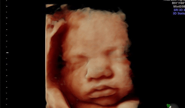 Republicans Demand Answers From FDA on Approval of Generic Abortion Pill