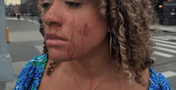 Savannah Craven Still Fighting for Justice After Abortion Activist Assaulted Her