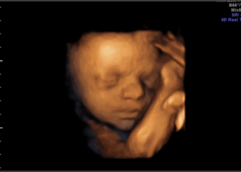 Spain and Luxembourg Want a Right to Kill Babies in Abortions