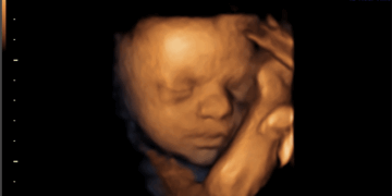 Spain and Luxembourg Want a Right to Kill Babies in Abortions