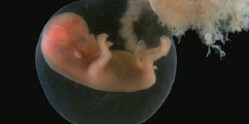 Tennessee Fights in Court to Protect Its Abortion Ban That’s Saving Babies