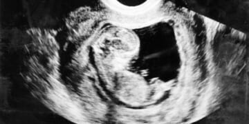 Thanks to Pro-Life Groups, Trump’s IVF Announcement Has Ethical Considerations