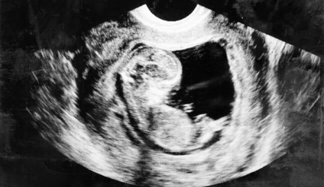 Thanks to Pro-Life Groups, Trump’s IVF Announcement Has Ethical Considerations