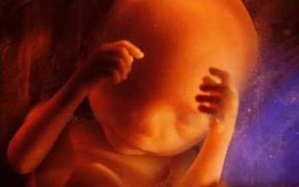 Trump Admin Joins 40 Countries Declaring There’s No Right to Abortion