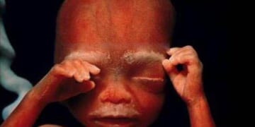 Ultrasound Photos Confirm the Truth: Abortions Kill Babies