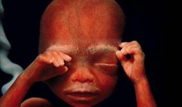 Ultrasound Photos Confirm the Truth: Abortions Kill Babies