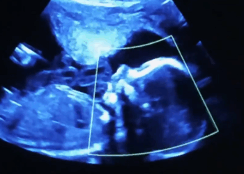 “Aborting Babies Just Sends Them to Heaven” is a False and Disgusting Claim