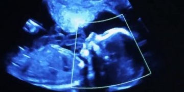 “Aborting Babies Just Sends Them to Heaven” is a False and Disgusting Claim