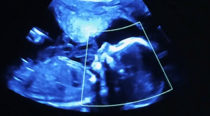 “Aborting Babies Just Sends Them to Heaven” is a False and Disgusting Claim