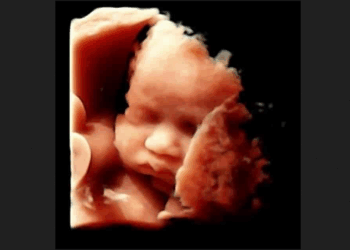 After Taking Friend for Abortion, Woman Realizes “I Had Taken Part in a Baby’s Death”