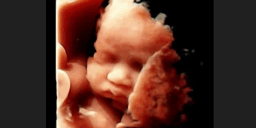 After Taking Friend for Abortion, Woman Realizes “I Had Taken Part in a Baby’s Death”