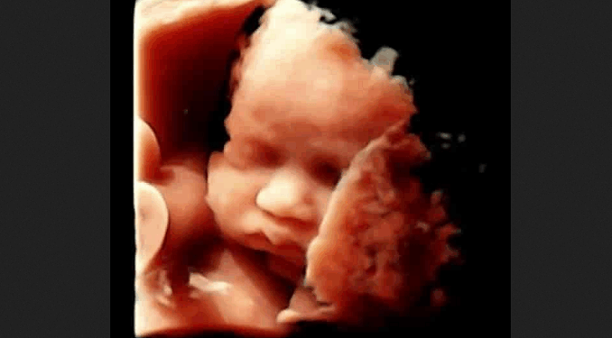 After Taking Friend for Abortion, Woman Realizes “I Had Taken Part in a Baby’s Death”