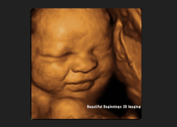 Australian State Defeats Bill to Protect Babies From Late-Term Abortions