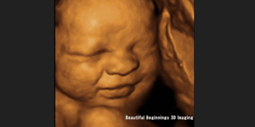 Australian State Defeats Bill to Protect Babies From Late-Term Abortions