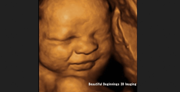 Australian State Defeats Bill to Protect Babies From Late-Term Abortions