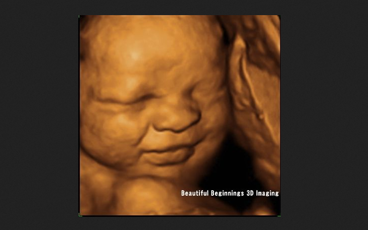 Australian State Defeats Bill to Protect Babies From Late-Term Abortions