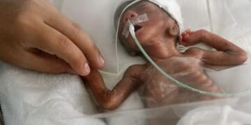 Babies Who Survive Abortions in New Zealand are Left to Die