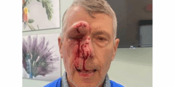 Elderly Pro-Life Advocate Asks Trump- Admin for Justice After He's Brutally Assaulted