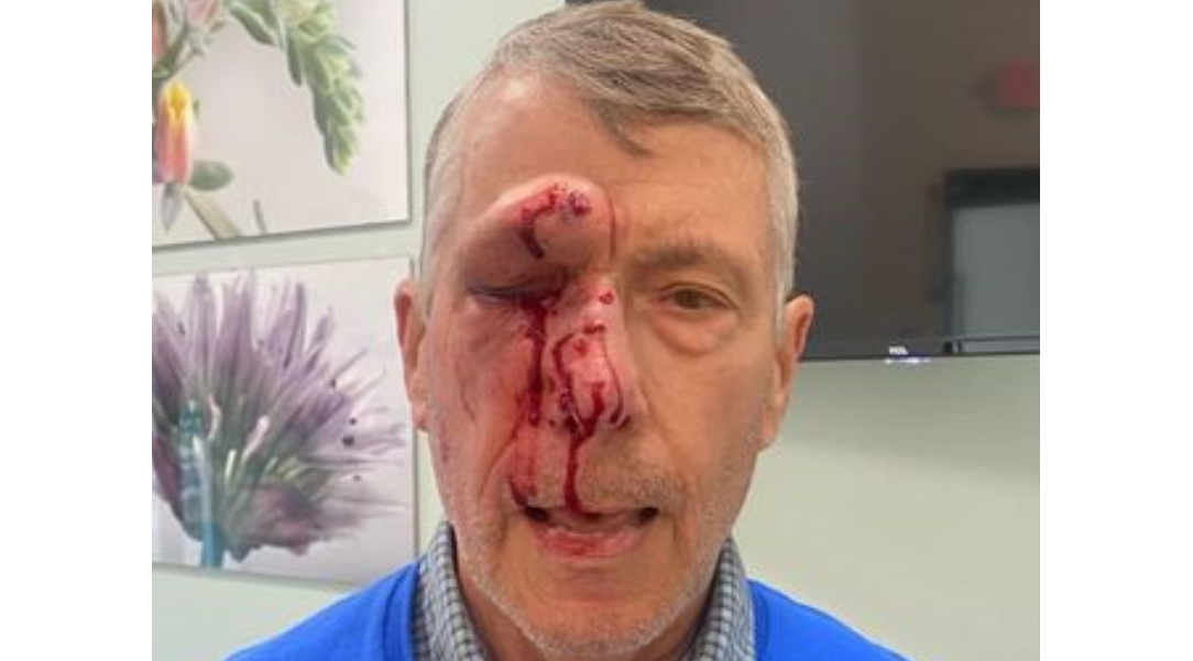 Elderly Pro-Life Advocate Asks Trump- Admin for Justice After He's Brutally Assaulted