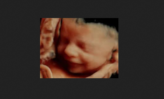 Even Liberals Say It’s Too Easy to Get Abortion Pills to Kill Babies